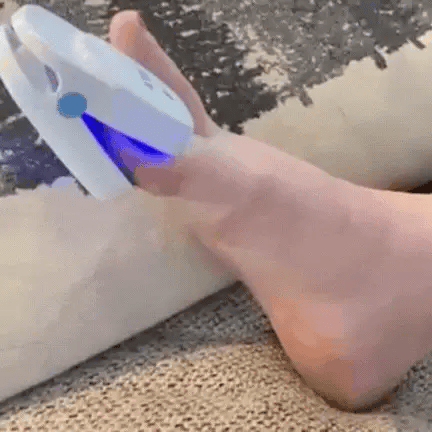 At-Home Laser Toenail Fungus Treatment Device