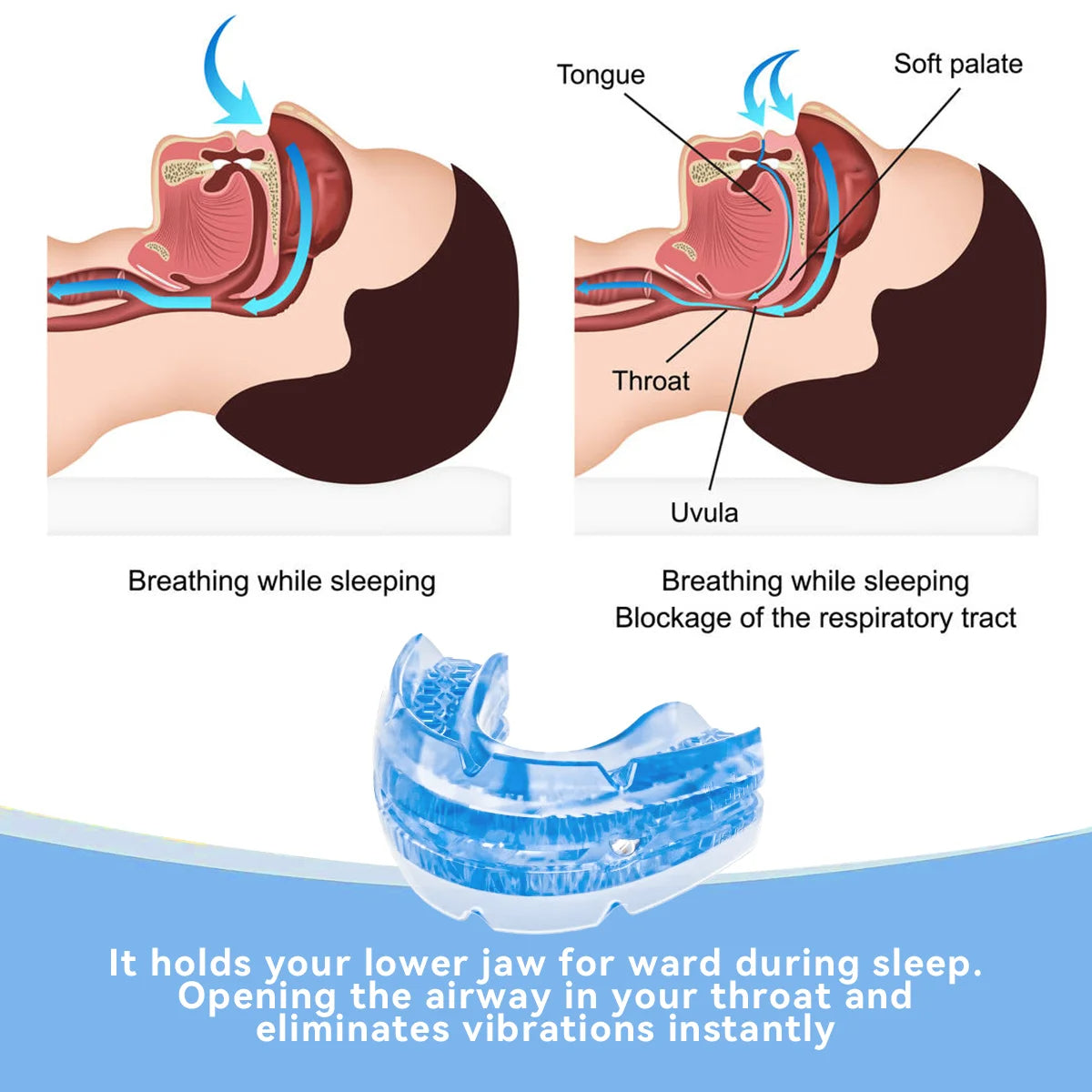 Adjustable BPA-Free Snoring Mouth Guard for Better Sleep