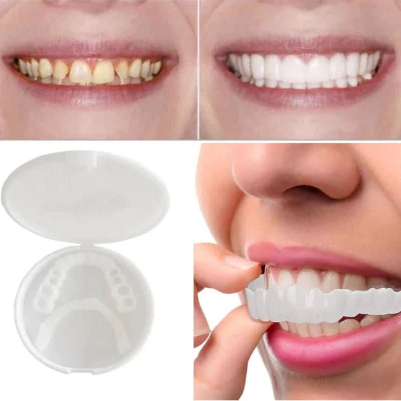 Snap-On Heat-Moldable Tooth Cover for Stained Teeth
