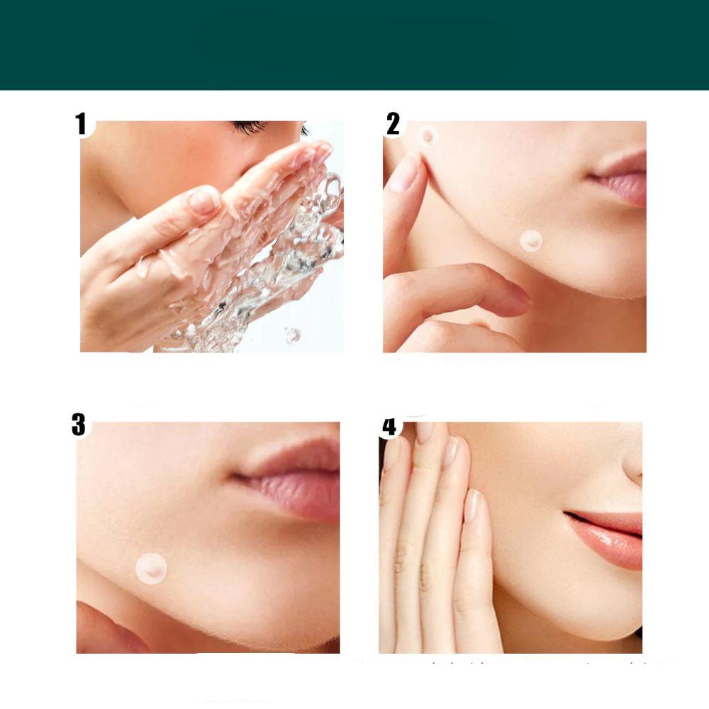 Painless Wart Remover for All Skin Types