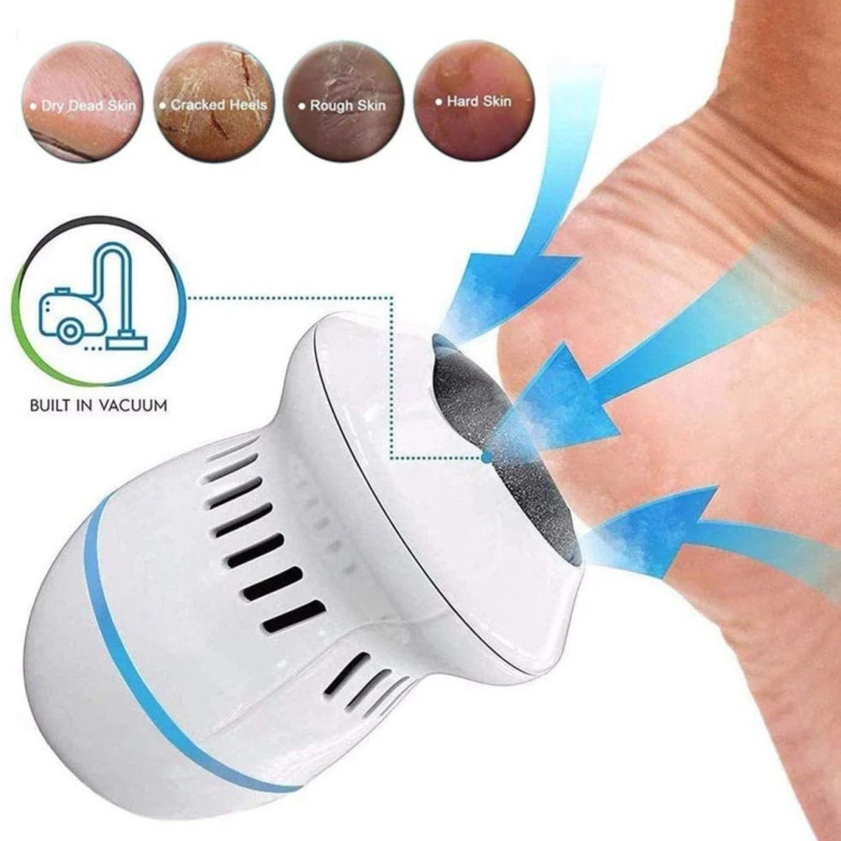 Electric Callus Remover with Ergonomic Grip and Washable Head