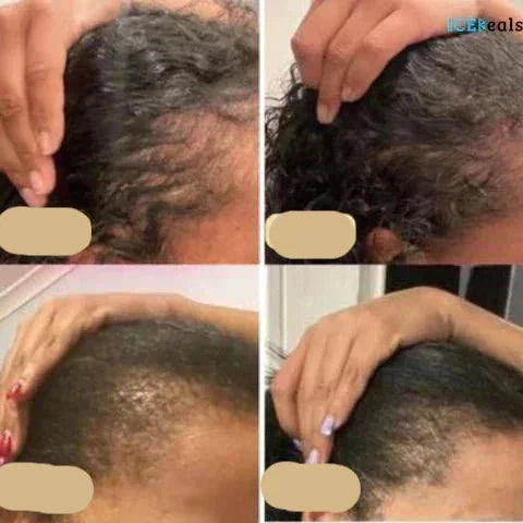 Natural Vegan Hair Oil for Healthy Hair Growth and Shine
