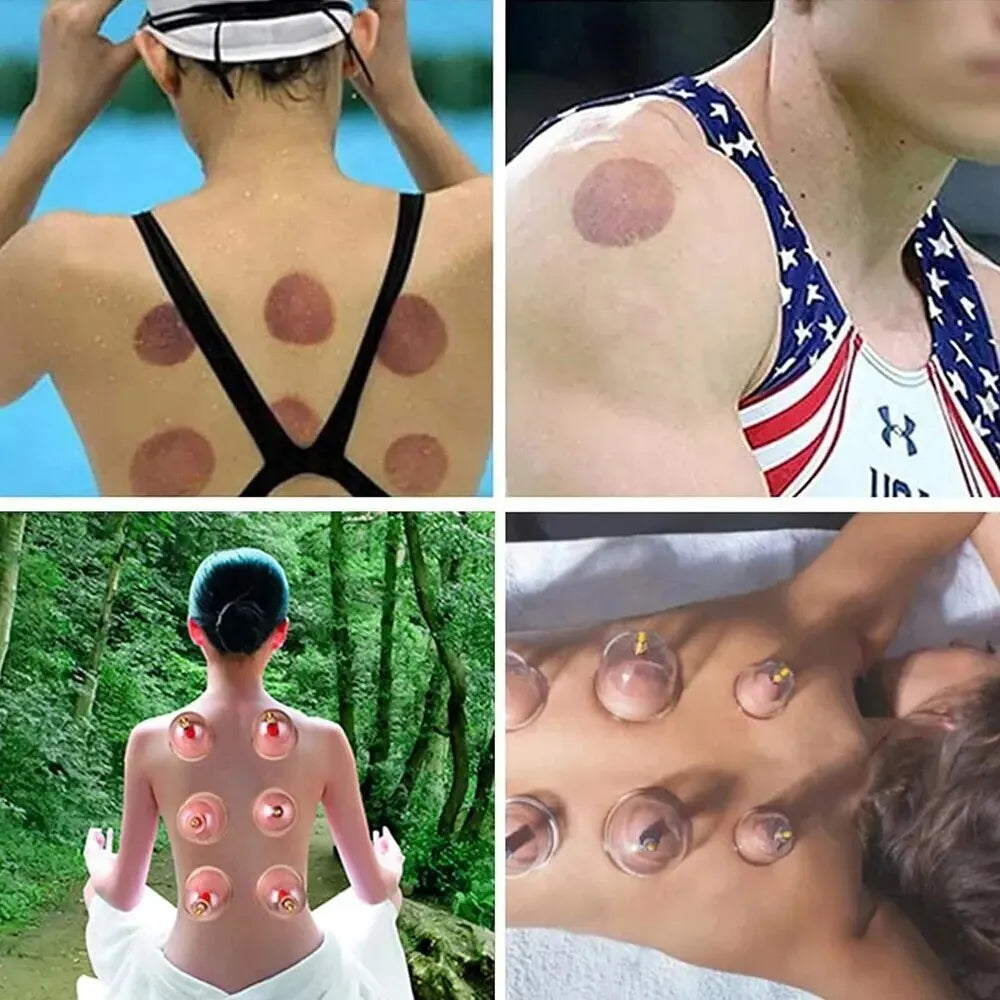 Vacuum Cupping Therapy Set for Muscle Relief