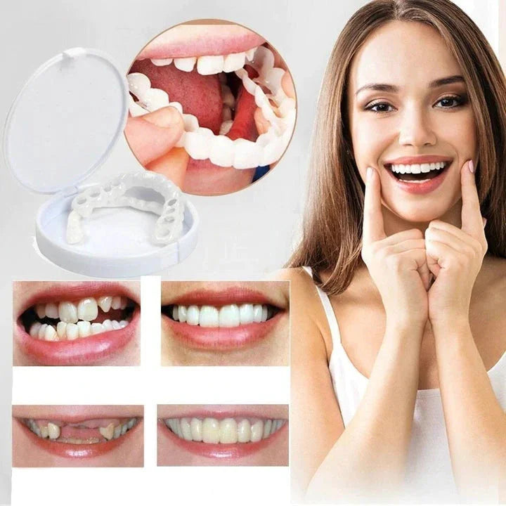 Snap-On Upper and Lower Teeth Veneers for a Natural Smile