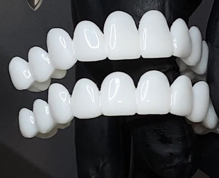 Snap-On Cosmetic Veneers for Instant Smile Makeover