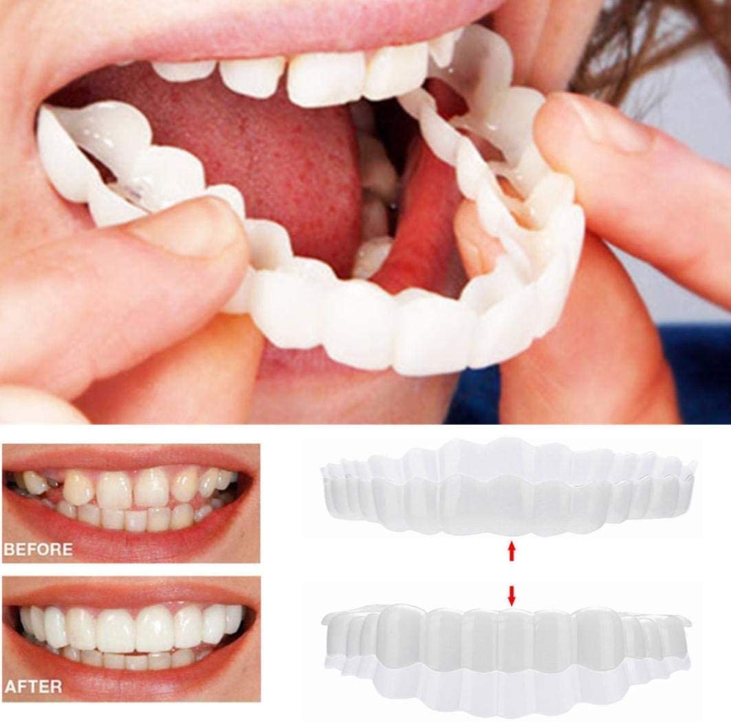 Smile Veneer Clip-On Teeth Cover for Flawless Smile
