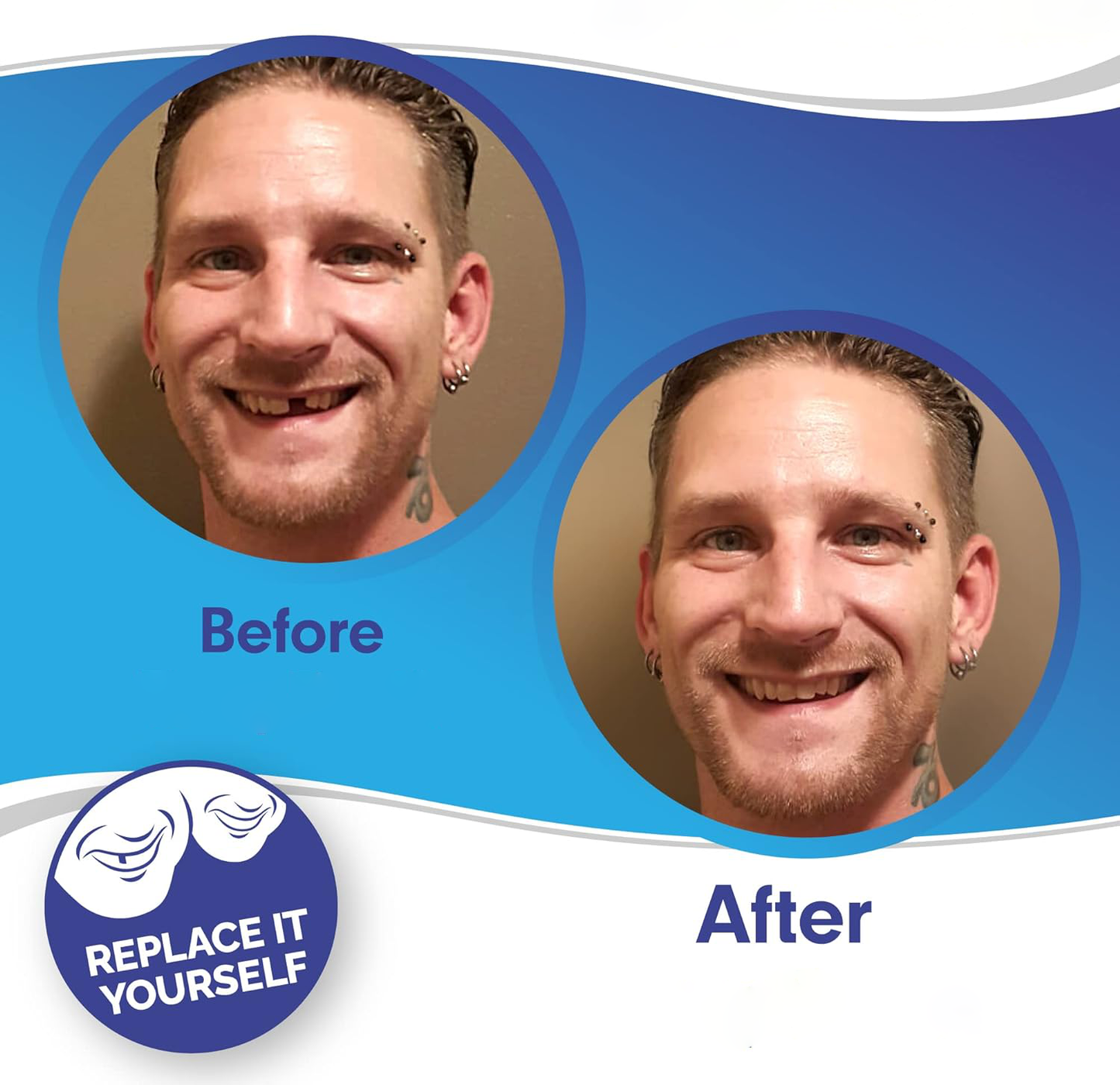 Smile Veneer Clip-On Teeth Cover for Flawless Smile