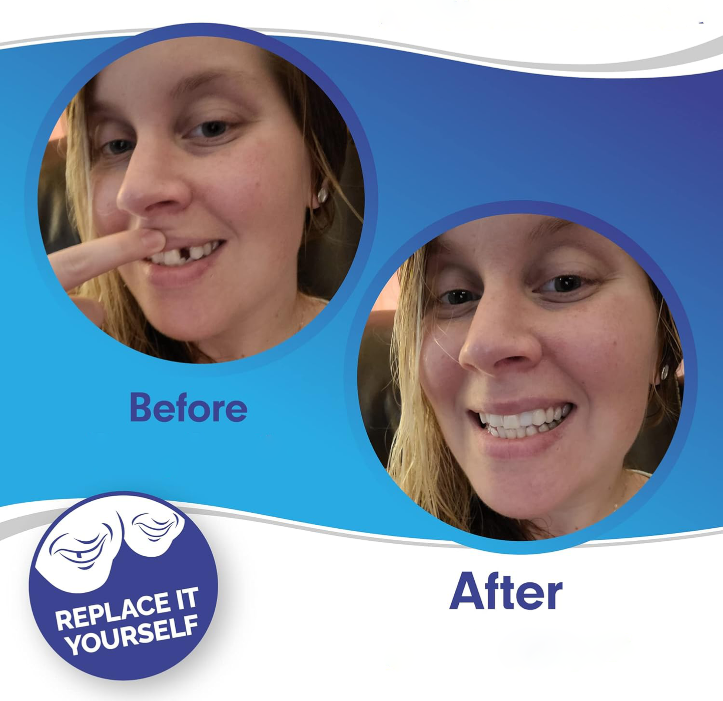 Smile Veneer Clip-On Teeth Cover for Flawless Smile