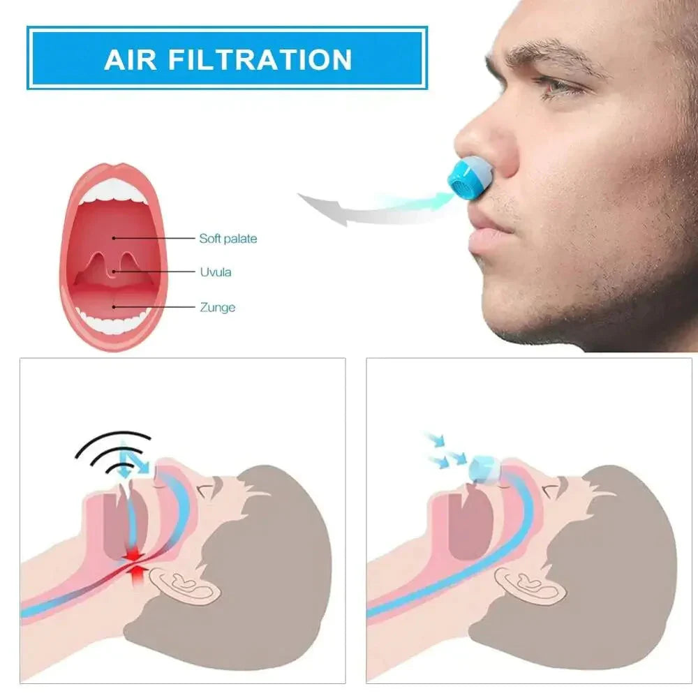 Portable Micro CPAP Sleep Apnea Machine for Travel – Anti-Snoring Solution