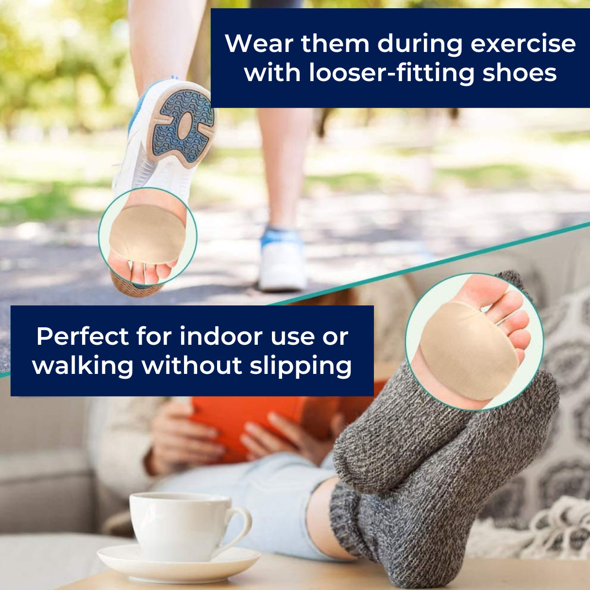 Gel Metatarsal Support Pads for Morton’s Neuroma Relief