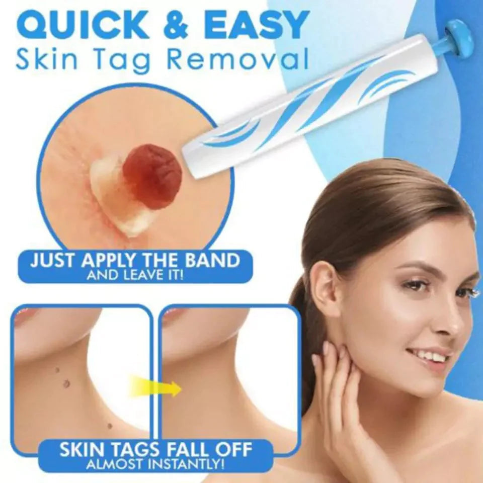 Skin Tag Removal Kit with Banding Tool for Warts and Moles