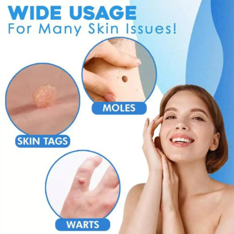 Skin Tag Removal Kit with Banding Tool for Warts and Moles