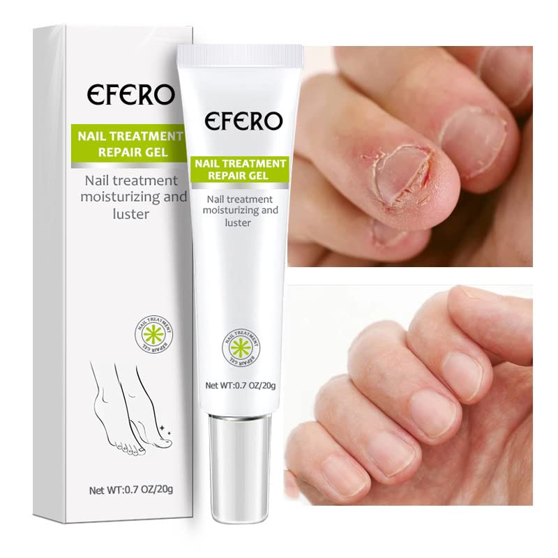 Moisturizing Gel for Weak and Discolored Nails