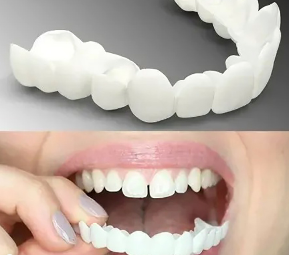 Snap-On Cosmetic Dentures for Missing or Crooked Teeth