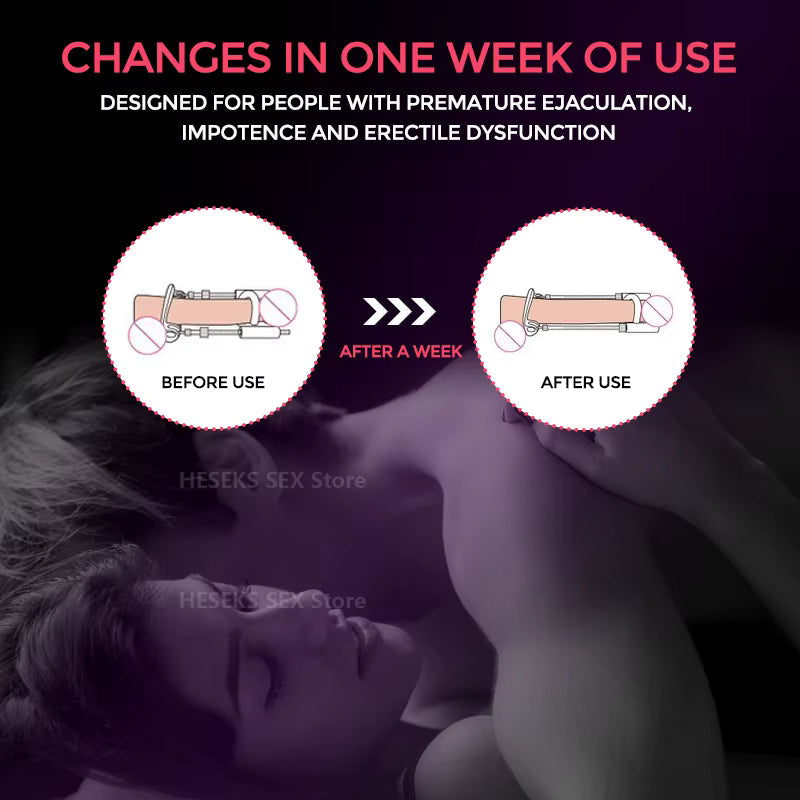 Male Traction Device for Enhancement and Support