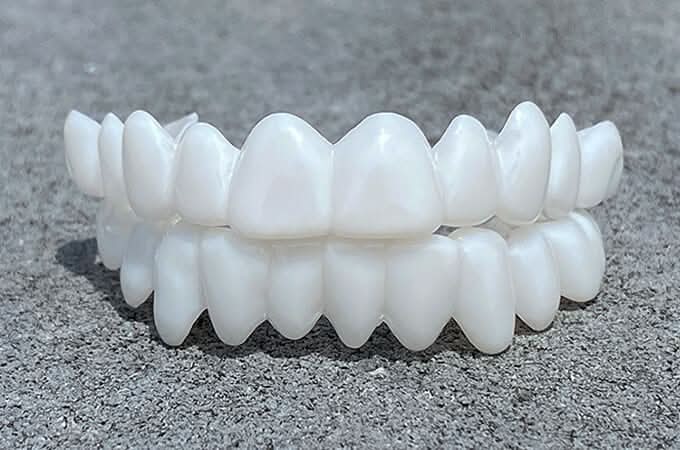 Flexible Dentures with Natural White Tooth Lenses