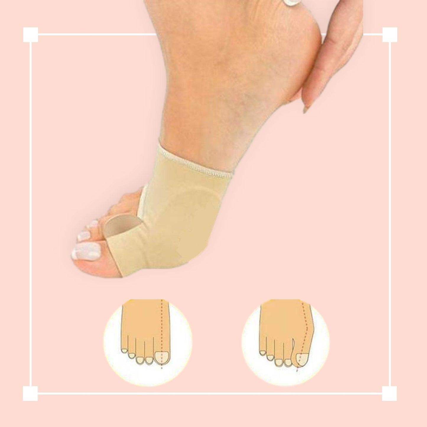 Orthopedic Bunion Corrector Sleeves for Pain Relief