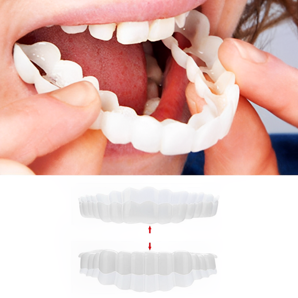 Clip-On Dental Veneers for Crooked or Stained Teeth - Comfortable & Natural Look