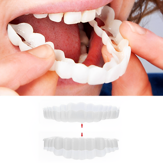 Clip-On Dental Veneers for Crooked or Stained Teeth - Comfortable & Natural Look