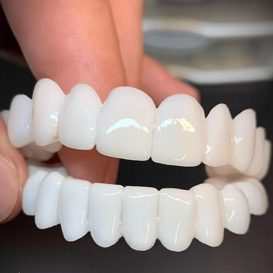 White Dental Prosthesis with Comfortable Lenses for a Radiant Smile
