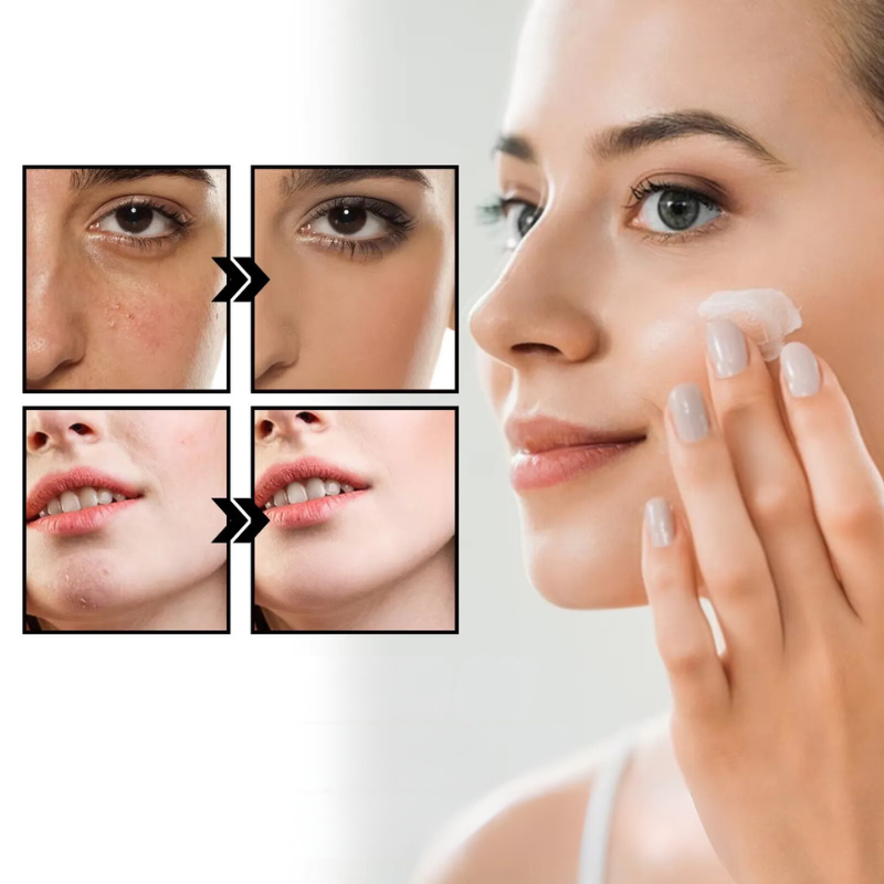 Soothing Cream for Rosacea and Sensitive Skin 1.7 oz