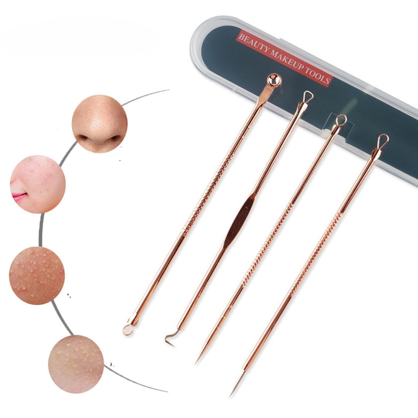 Blackhead Remover Comedone Extractor Kit with Protective Case