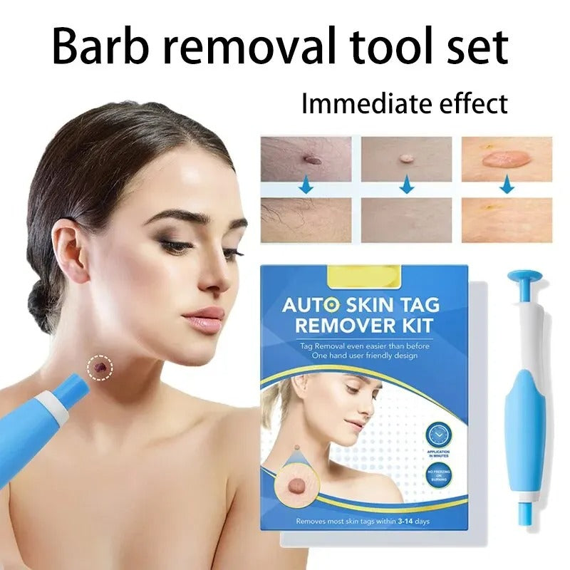 At-Home Skin Tag Removal Kit with Ligation Bands
