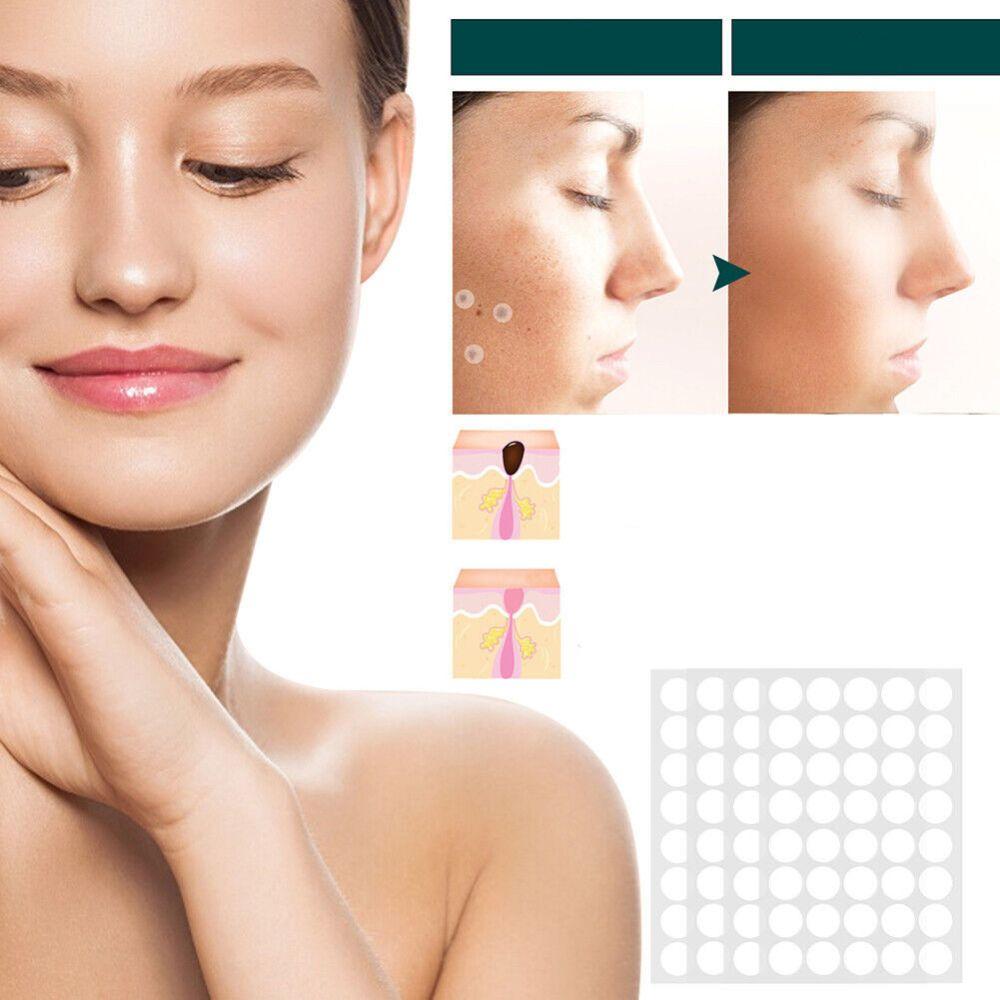 Painless Wart Remover for All Skin Types