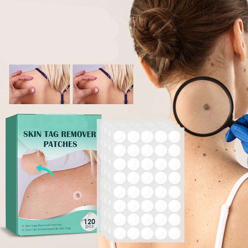 Painless Wart Remover for All Skin Types