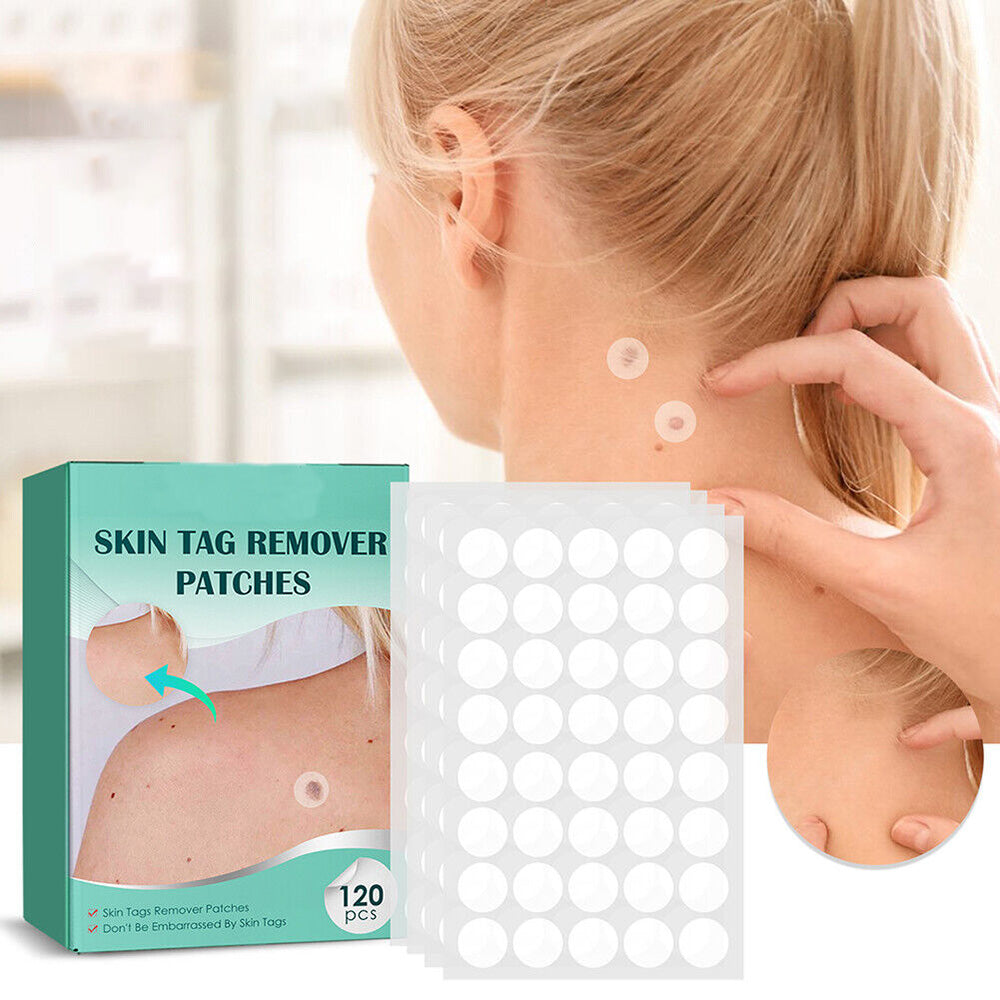 Painless Wart Remover for All Skin Types