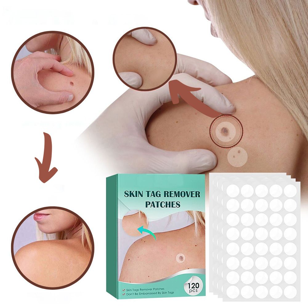 Painless Wart Remover for All Skin Types