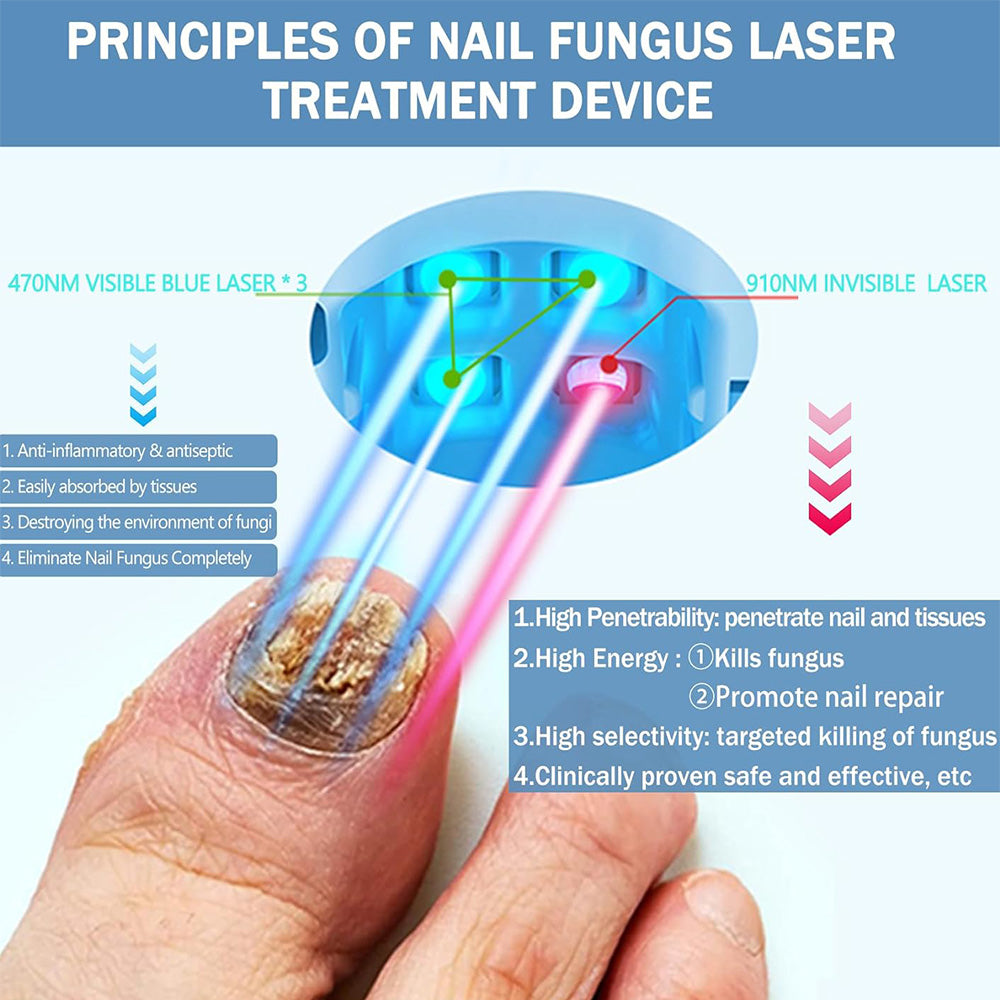 At-Home Laser Toenail Fungus Treatment Device