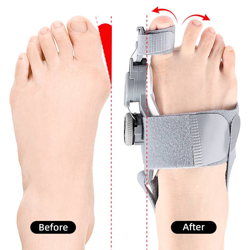 Adjustable Natural Bunion Corrector Toe Spacer