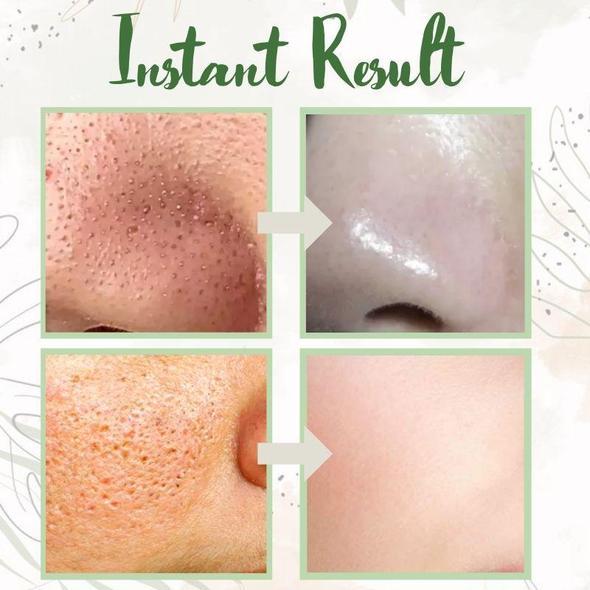 Deep Cleansing Green Tea Face Mask for Radiant Skin