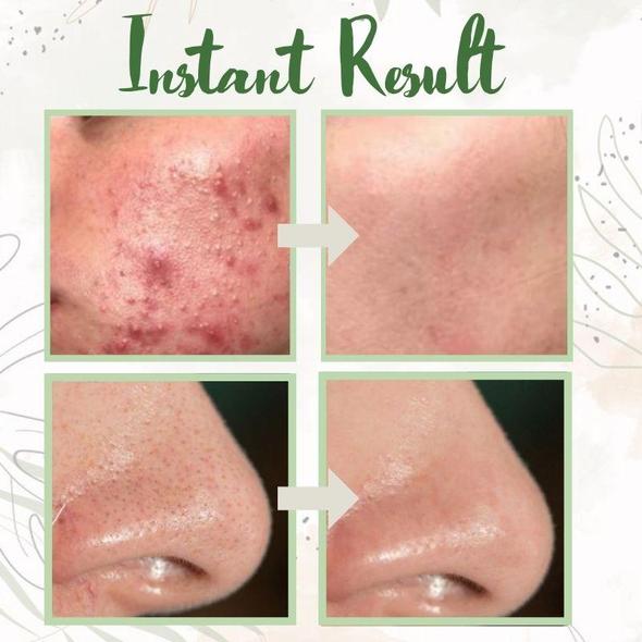 Deep Cleansing Green Tea Face Mask for Radiant Skin