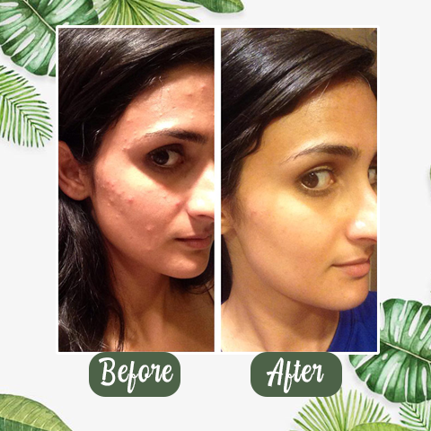 Deep Cleansing Green Tea Face Mask for Radiant Skin