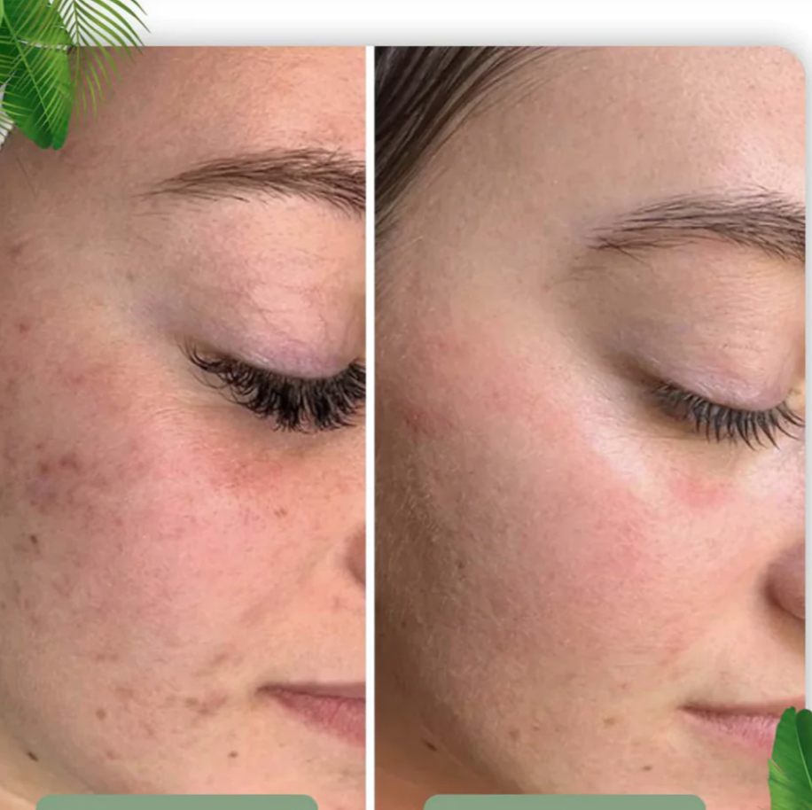 Green Tea Face Mask Stick for Deep Cleansing and Pore Minimizing