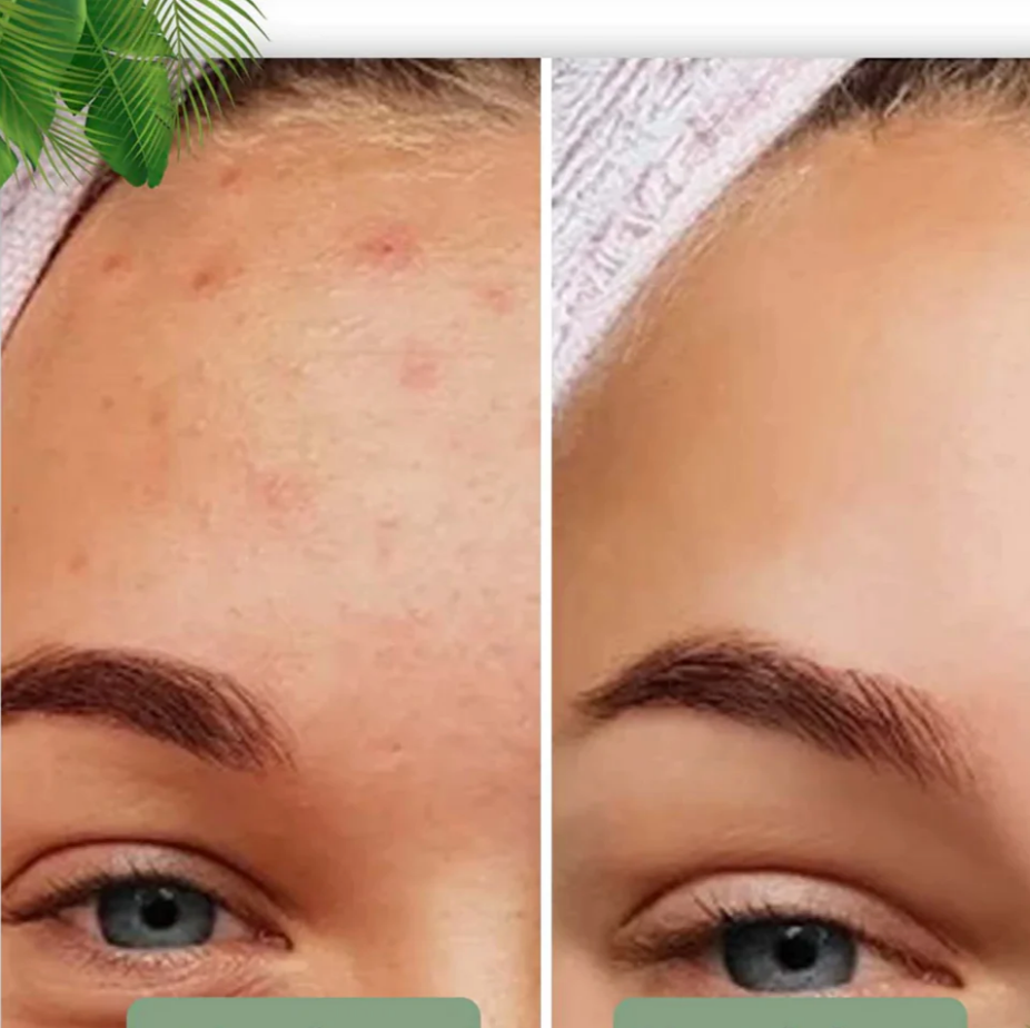 Green Tea Face Mask Stick for Deep Cleansing and Pore Minimizing