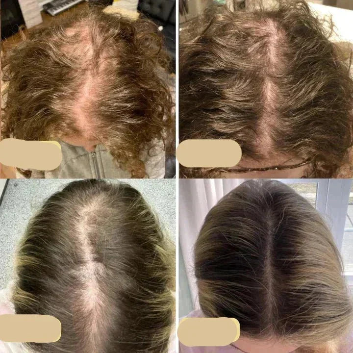 Natural Vegan Hair Oil for Healthy Hair Growth and Shine