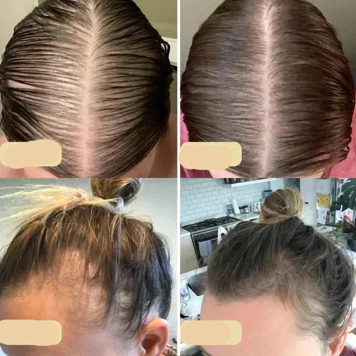 Natural Vegan Hair Oil for Healthy Hair Growth and Shine