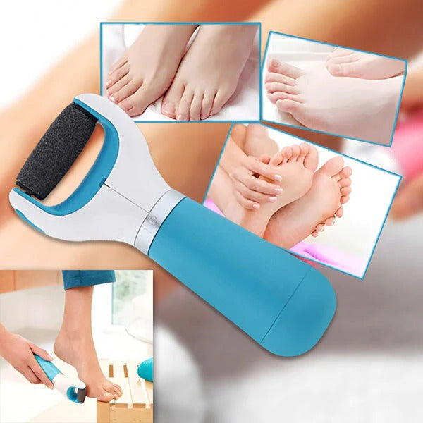 Rechargeable Electric Callus Remover for Smooth Feet