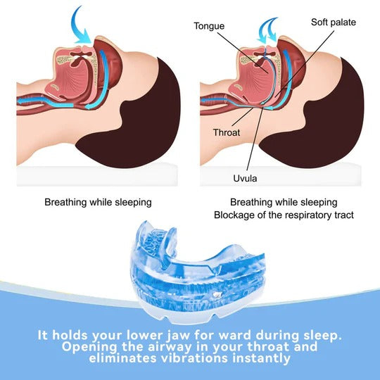 Adjustable BPA-Free Anti-Snore Mouthpiece for Jaw Alignment