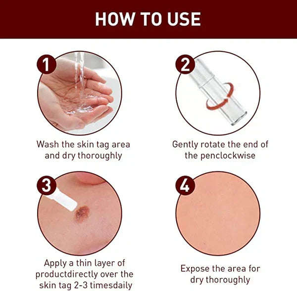 Skin Tag and Mole Remover with Tea Tree Oil