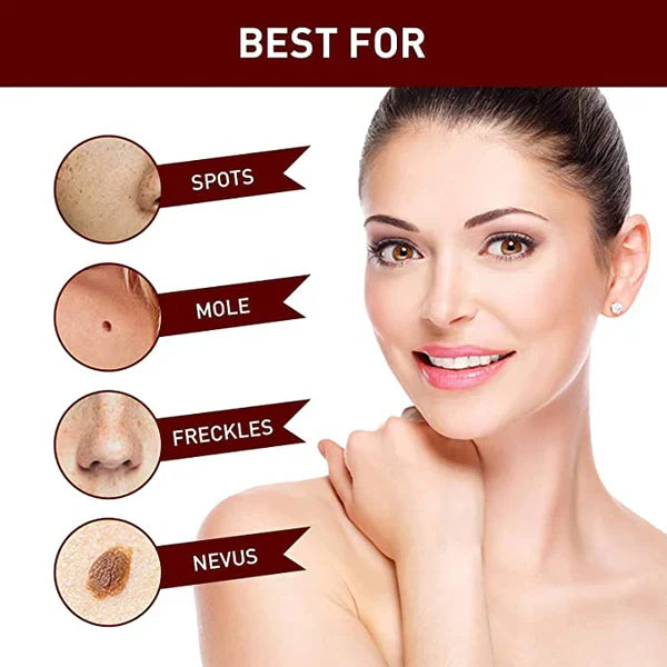 Skin Tag and Mole Remover with Tea Tree Oil