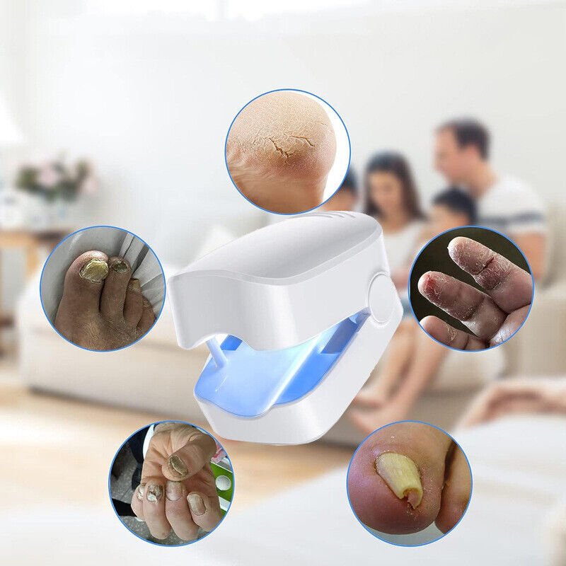 Pain-Free Laser Treatment Device for Nail Fungus