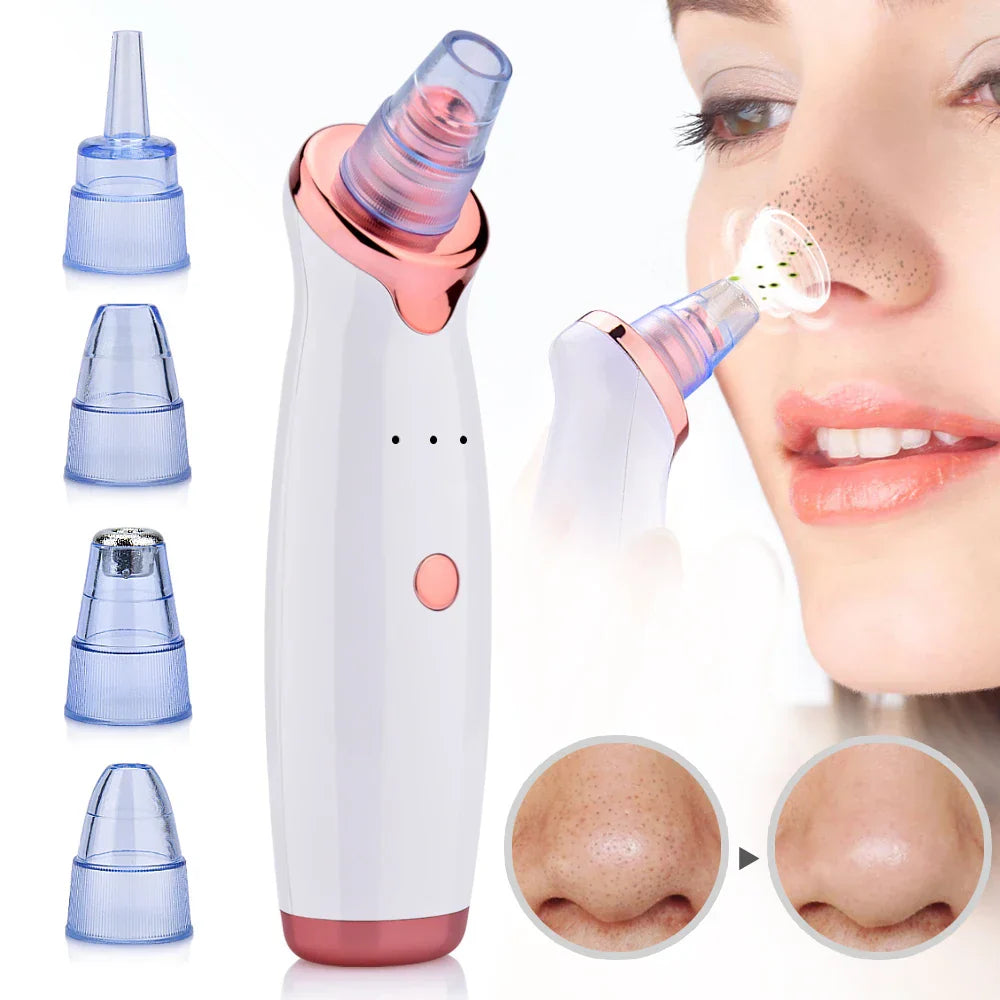 Vacuum Skincare Device for Blackhead and Acne Removal