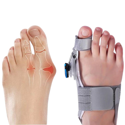 Adjustable Natural Bunion Corrector Toe Spacer