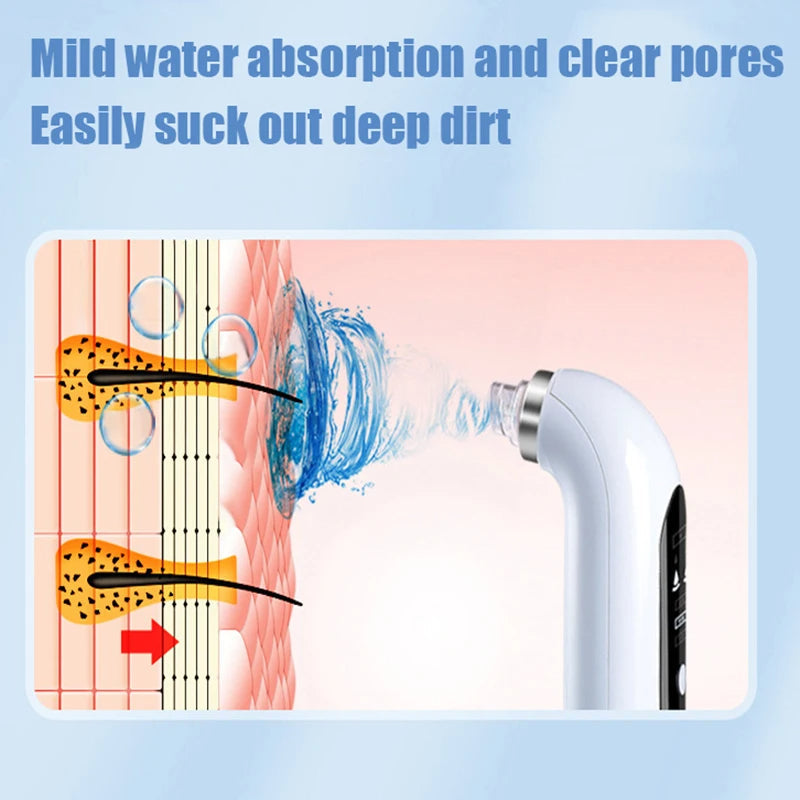 Electric Blackhead Remover Vacuum with Blue Light Technology
