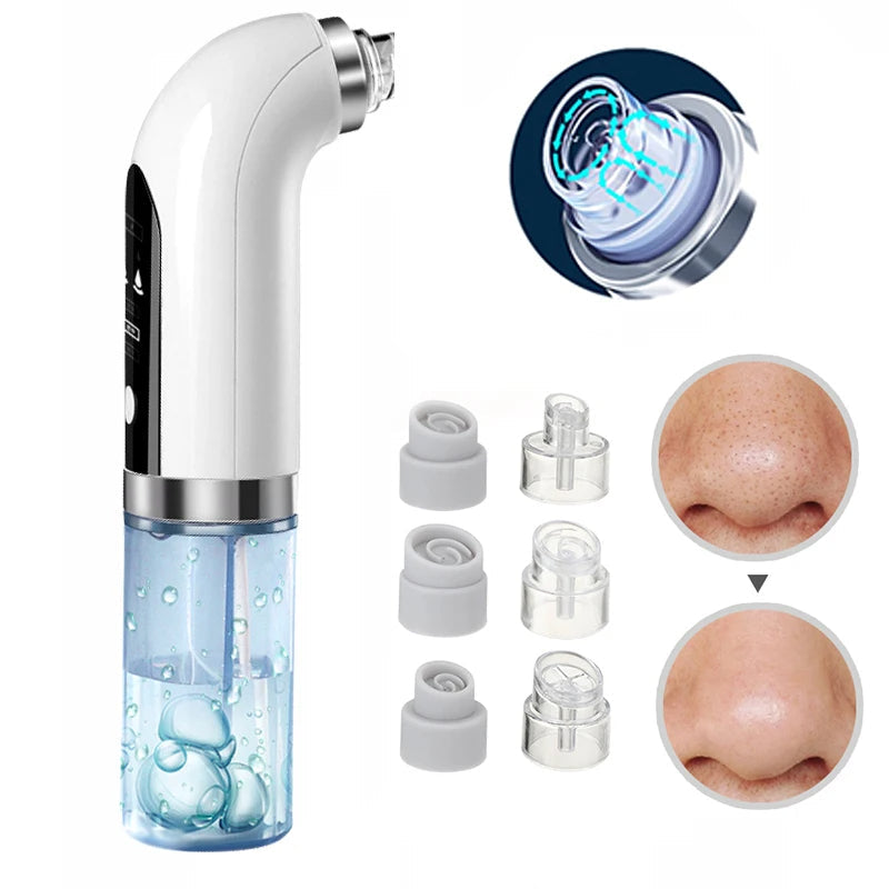 Electric Blackhead Remover Vacuum with Blue Light Technology