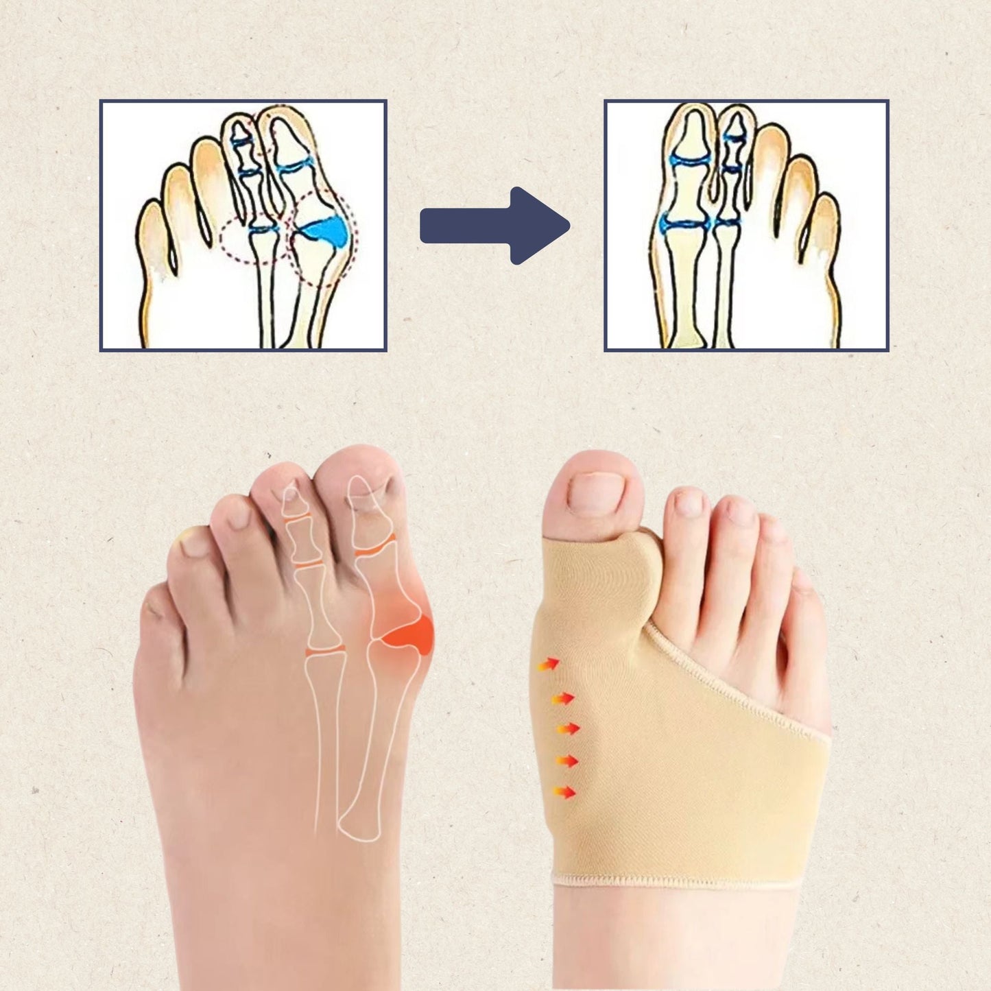 Natural Big Toe Corrector for Hallux Valgus Relief
